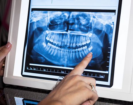 Pointing to X-ray on a computer screen