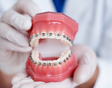 Close-up of gloved hands holding model of teeth with braces