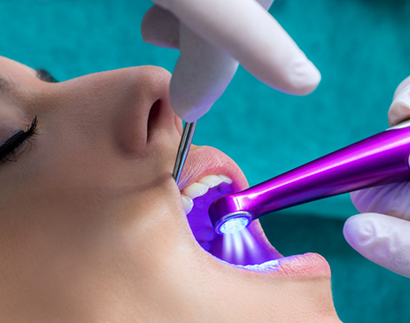 Close-up of dental patient having dental sealants applied