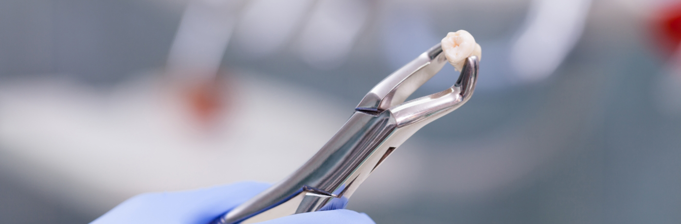 Close-up of forceps holding tooth after a tooth extraction