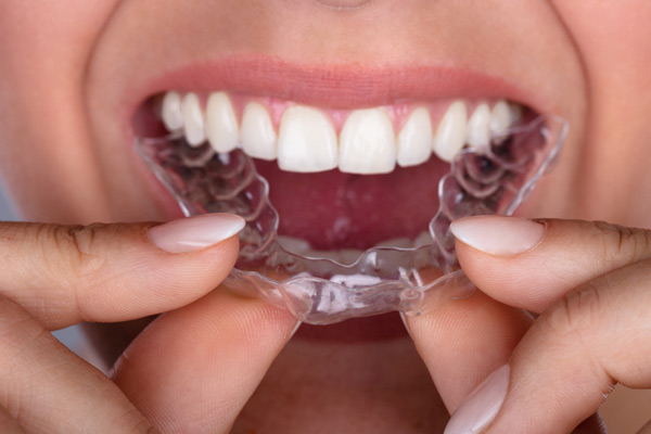 Close up of a woman putting Invisalign on her teeth.